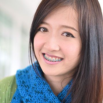 color my braces